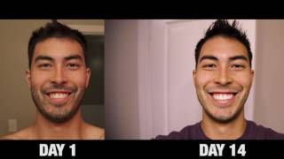 Does Whitening Toothpaste Really Work  Crest 3D White Luxe Review [upl. by Ytak567]