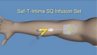 How to Insert SafTIntima™ SQ Infusion Set [upl. by Cleopatra218]