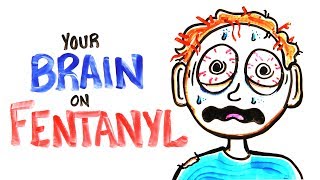 Your Brain On Fentanyl FIXED [upl. by Aztilay661]