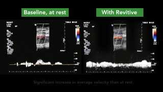 How REVITIVE increases circulation [upl. by Demeter]