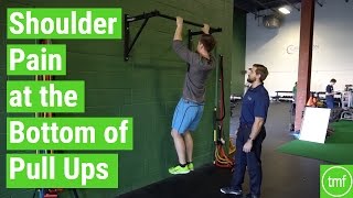 Shoulder Pain During Pull Ups  Ep 112  Movement Fix Monday  Dr Ryan DeBell [upl. by Aidekal]