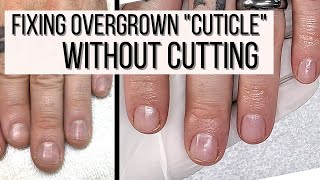 How to FIX Overgrown Cuticles WITHOUT CUTTING [upl. by Ilak]