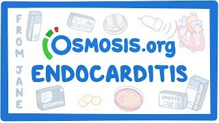 Clinicians Corner Endocarditis [upl. by Adamski]