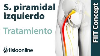 Tratamiento del síndrome piramidal izquierdo [upl. by Ahcsas]