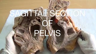 SAGITTAL SECTION OF PELVIS  DEMONSTRATION  ANATOMY [upl. by Oivat372]