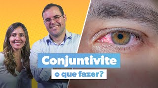 Conjuntivite viral alérgica ou bacteriana Como tratar  com Dr Arthur Frazão [upl. by Cedric]