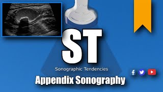 Appendix Ultrasound [upl. by Nolyad483]