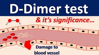 Ddimer test and its significance [upl. by Socram864]