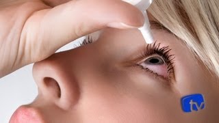 Conjuntivite inflamação provoca vermelhidão coceira e inchaço nos olhos [upl. by Birch195]