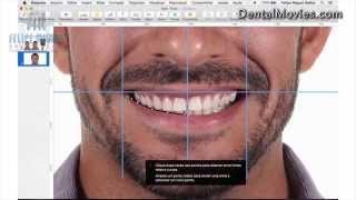 DSD  Digital Smile Design by Felipe Miguel [upl. by Aenyl]