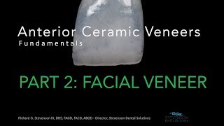 Anterior Ceramic Veneers Part 2 Facial Veneer [upl. by Avah]