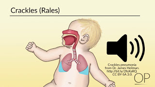 Respiratory Assessment by B Leary L DelSignore  OPENPediatrics [upl. by Resa]