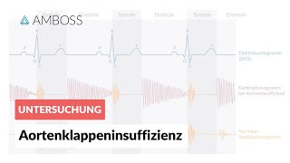 Aortenklappeninsuffizienz  Herzgeräusch  AMBOSS Video [upl. by Idnib]