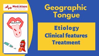 Geographic tongue Benign Migratory Glossitis [upl. by Nagy234]