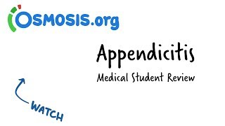 Appendicitis  Clinical Presentation [upl. by Camel]