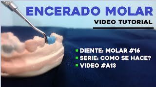 Encerado Dental Primer Molar Superior Parte 13 [upl. by Shanta736]