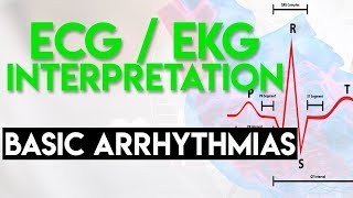 Basic Arrhythmias  Sinus Brady Tachy Premature Beats  ECG EKG Interpretation Part 3 [upl. by Pascia627]