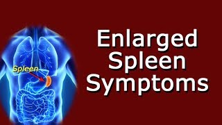 Enlarged Spleen Symptoms [upl. by Ailicec247]