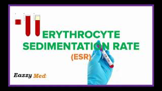 Erythrocyte Sedimentation Rate ESR Made Simple [upl. by Kondon550]