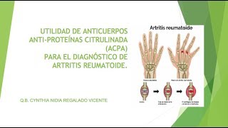 ANTICUERPOS ANTIPROTEÍNAS CITRULINADA [upl. by Ytsirt]