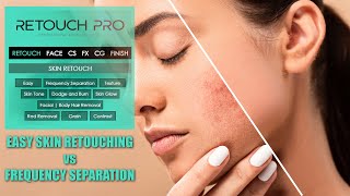 Retouch Pro Tutorial  Easy Skin Retouching vs Frequency Separation [upl. by Ehrman]