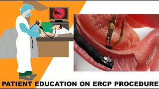 Patient Education On ERCP Procedure [upl. by Waine]