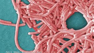 Legionnaires Disease What You Need to Know [upl. by Dewitt]