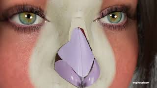 How to Tape the Nose After a Rhinoplasty  Proper Removal [upl. by Esertap]