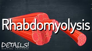 Rhabdomyolysis  Details [upl. by Trow]