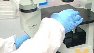 Stem cell cure for blindness tested  BBC News [upl. by Goodman]