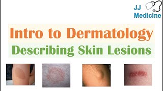 Introduction to Dermatology  The Basics  Describing Skin Lesions Primary amp Secondary Morphology [upl. by Tteltrab]