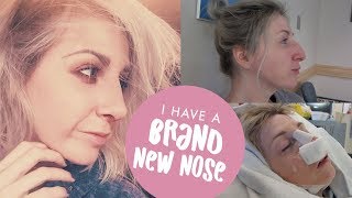 NOSE JOB VLOG  From Surgery to Recovery Rhinoplasty  Septorhinoplasty Journey [upl. by Chon]