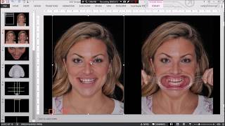 Digital Smile Design DSD using Microsoft PowerPoint  Full protocol [upl. by Marcelo]