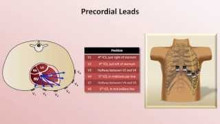 Intro to EKG Interpretation  EKG Leads [upl. by Cynarra804]