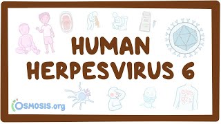 Human herpesvirus 6 Roseola  an Osmosis Preview [upl. by Mendy934]