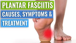 Plantar Fasciitis  Diagnosis And Treatment [upl. by Sisely]