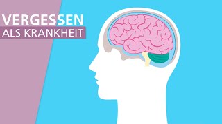 Alzheimer Die häufigste From von Demenz  Stiftung Gesundheitswissen [upl. by Viehmann]