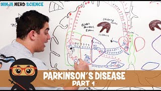 Parkinsons Disease  Clinical Presentation  Part 1 [upl. by Alhahs322]