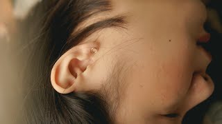 Why Does Fluid Build Up Behind The Eardrum Otitis Media With Effusion [upl. by Dinsmore]