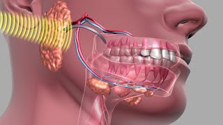 Oral Cancer Screening Exam [upl. by Lantz731]