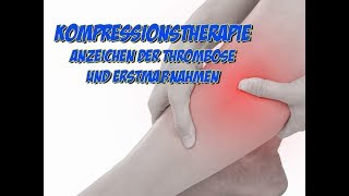 Kompressionstherapie  Symptome der Thrombose und Erstmaßnahmen [upl. by Bose776]