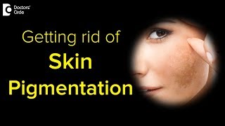 What causes skin pigmentation and how to get rid of it [upl. by Sonaj]