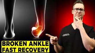 BEST Ankle Fracture amp Broken Ankle Recovery Time 2024 25 BEST TIPS [upl. by Inahpit]