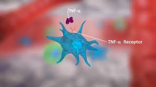 TN Alpha Inhibitors in Rheumatoid Arthritis [upl. by Enened849]