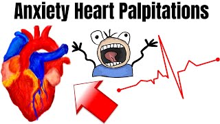 S1 Heart Sounds and Murmurs  First Heart Sound  Dr Najeeb🫀 [upl. by Nafis303]