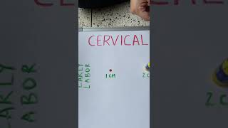 Cervical Dilation during Labor [upl. by Anairdna]