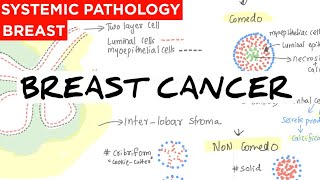 Systemic pathology 68  Breast 3  classification of breast cancer [upl. by Gibbs]