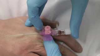 Cannulation How to gain IV access [upl. by Eesdnil]