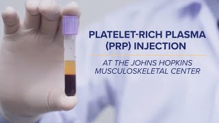 PlateletRich Plasma PRP Injections  QampA [upl. by Daitzman597]