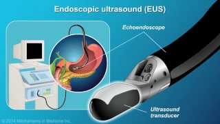 Understanding EUSFNA [upl. by Ketchan]